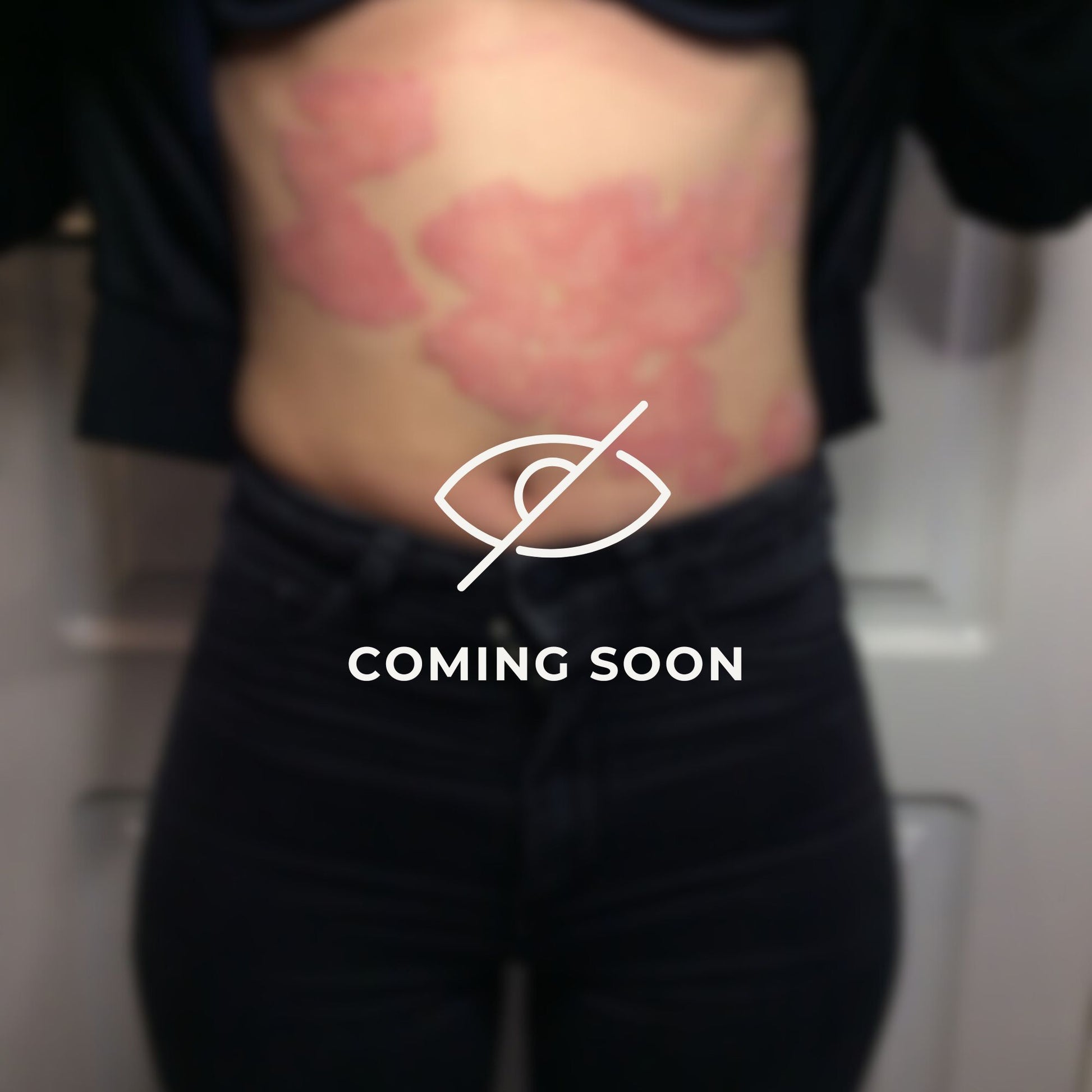 ScKIN Nutrition, Psoriasis Program